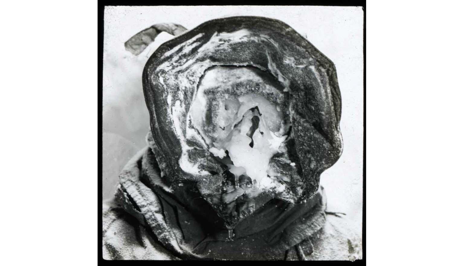 A black and white photo of a person with a hooded head and ice where the face should be.