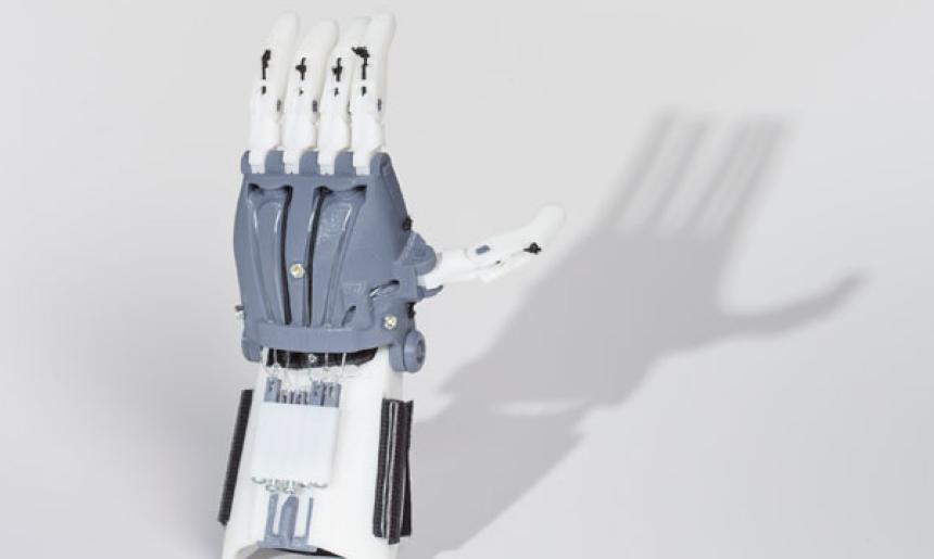 Image of 3D printed prosthetic hand